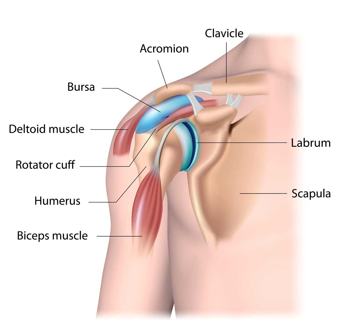 Read more about the article Shoulder Pain – Impingement and Bursitis